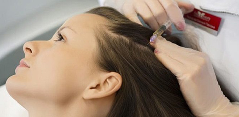 مزوتراپی پوست و مو و لاغری