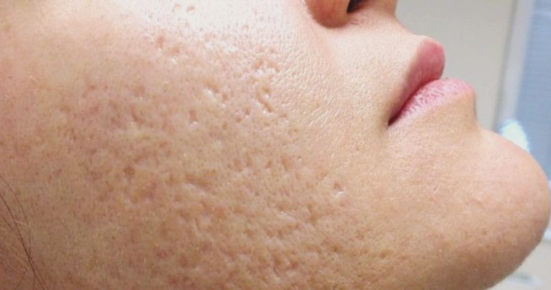 منافذ باز پوست