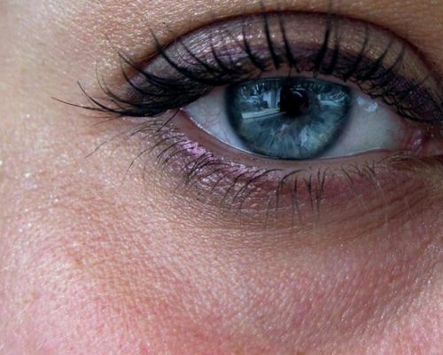 برای رفع پف و تیرگی زیر چشم چه کنیم؟