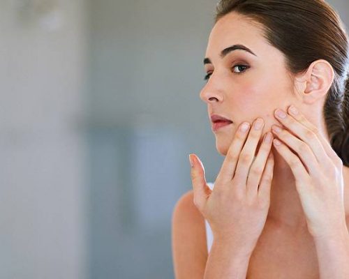 دلایل جوش و آکنه روی پوست