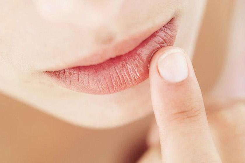 چگونه خشکی لب را از بین ببریم؟