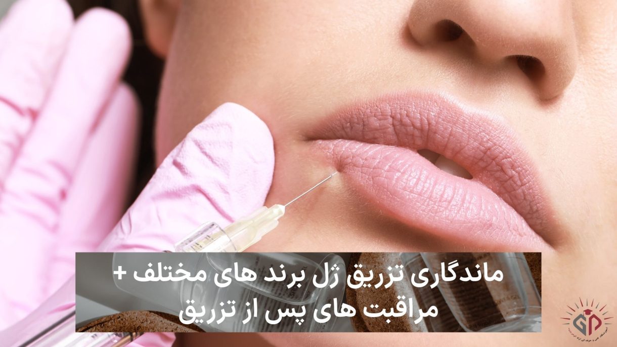 ماندگاری تزریق ژل برند های مختلف + مراقبت های پس از تزریق