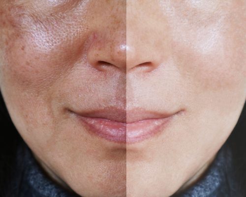 دستگاه هیدروفیشیال